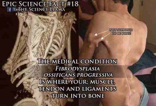 Muscles turning into bones