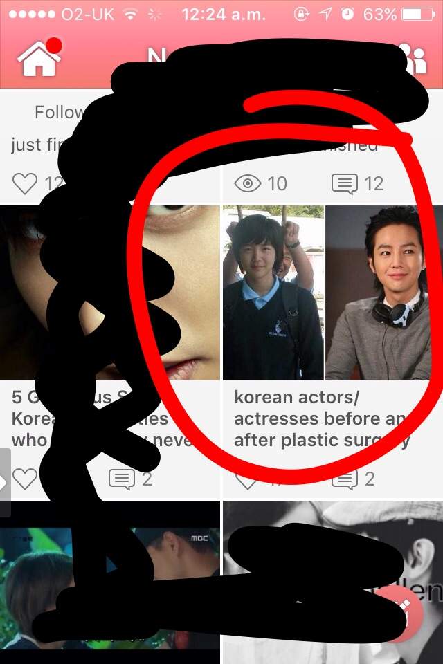 korean actors/actresses before and after plastic surgery