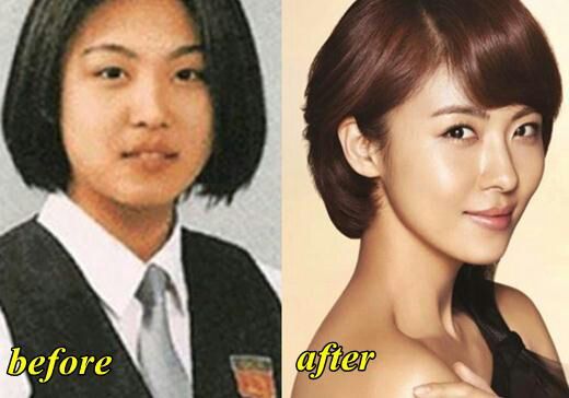 K Drama Actresses Before And After K Drama Amino 