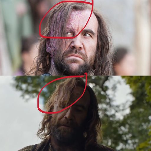 hair of the hound