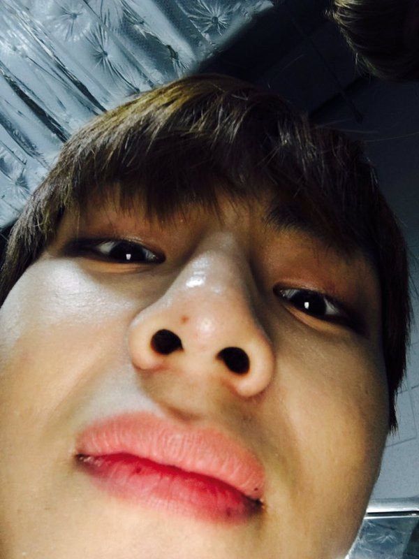 Kim Taehyung's nose freckle | K-Pop Amino