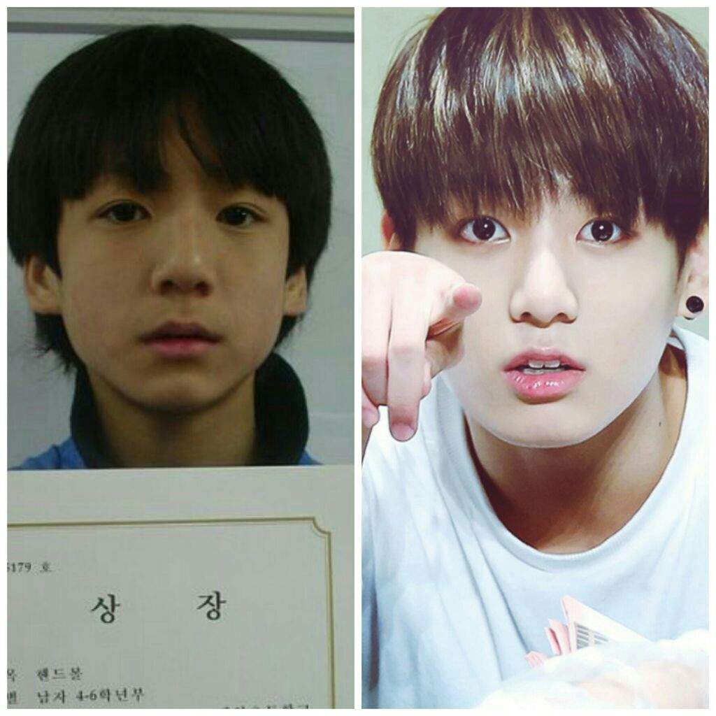 Bts Plastic Surgery Before And After Bts Have Plastic Surgery Karamastar