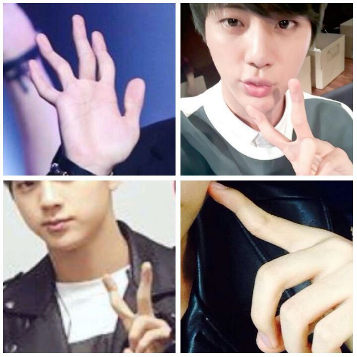 Conoce la posible enfermedad de Jin | ARMY's Amino Amino Conoce la posible enfermedad de Jin | ARMY's Amino Amino