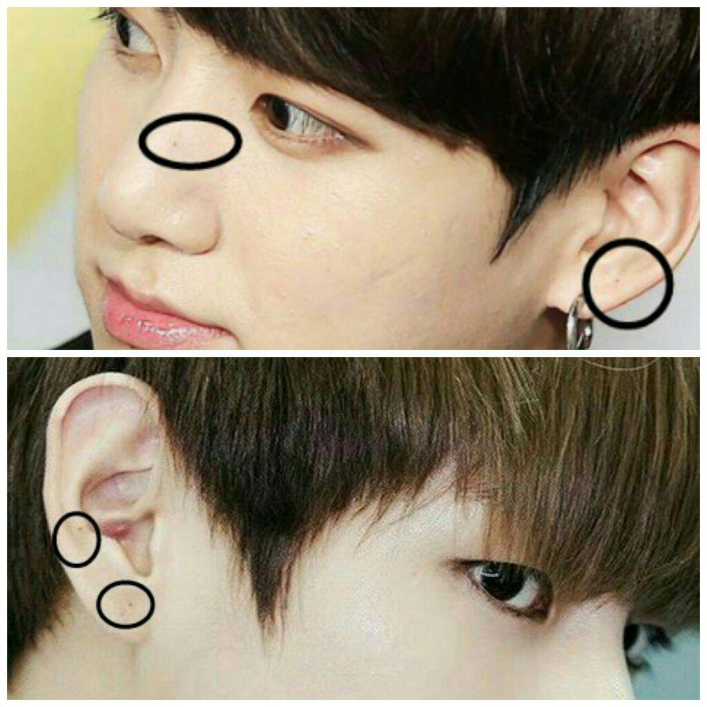 Bts Moles Implications Armys Amino