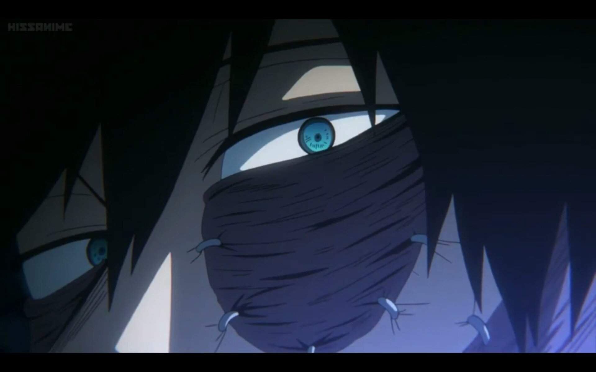 Featured image of post Does Dabi Have A Lazy Eye So my right eye is completely normal and usually what i do when my friends ask me is i raise both hands to my right eye to make a very large circle to show how much i see with my right