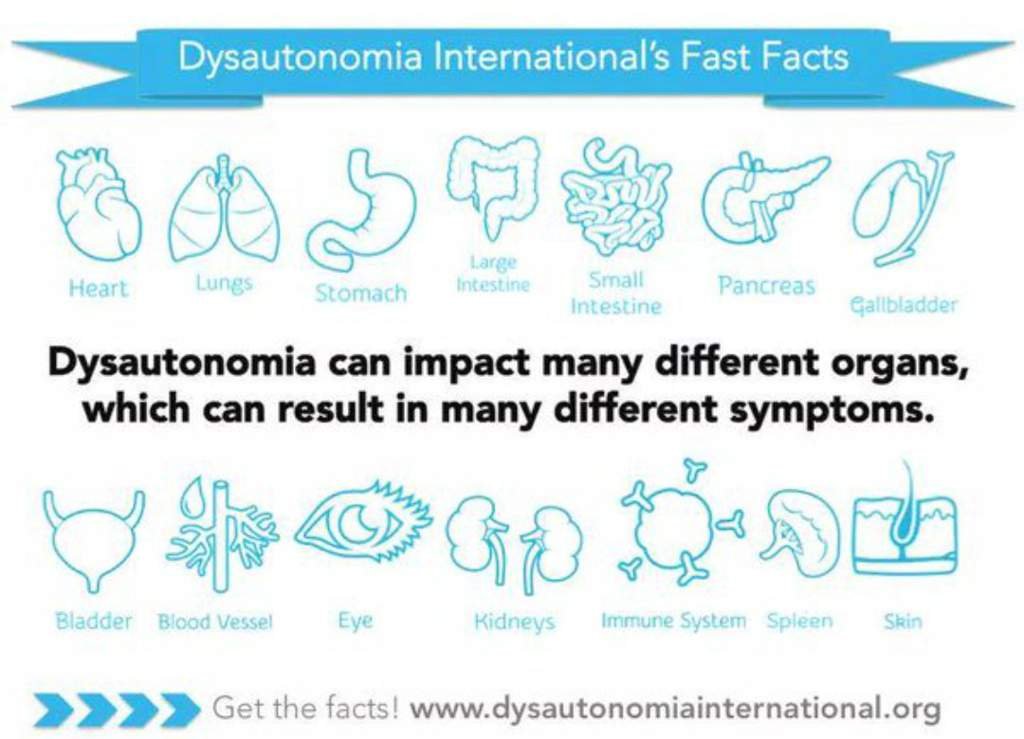 CARDIOVASCULAR AUTONOMIC DYSFUNCTION IN EDS Wiki EDS (Ehlers Danlos