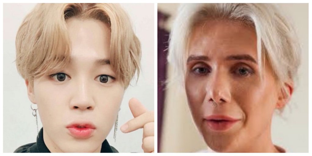 This dude tried getting plastic surgery to look like Jimin... | K-Pop Amino