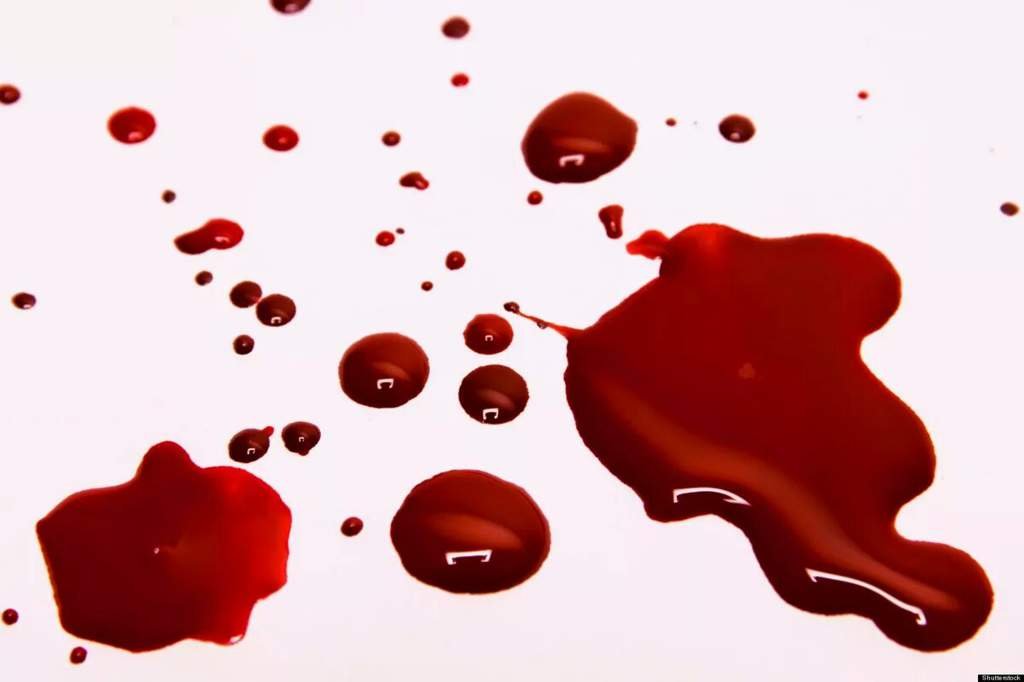 كيفية إزالة بقع الدم من على الملابس