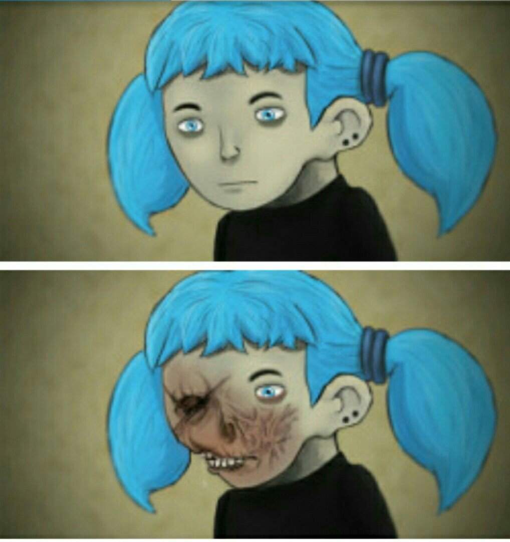 Sally face scars