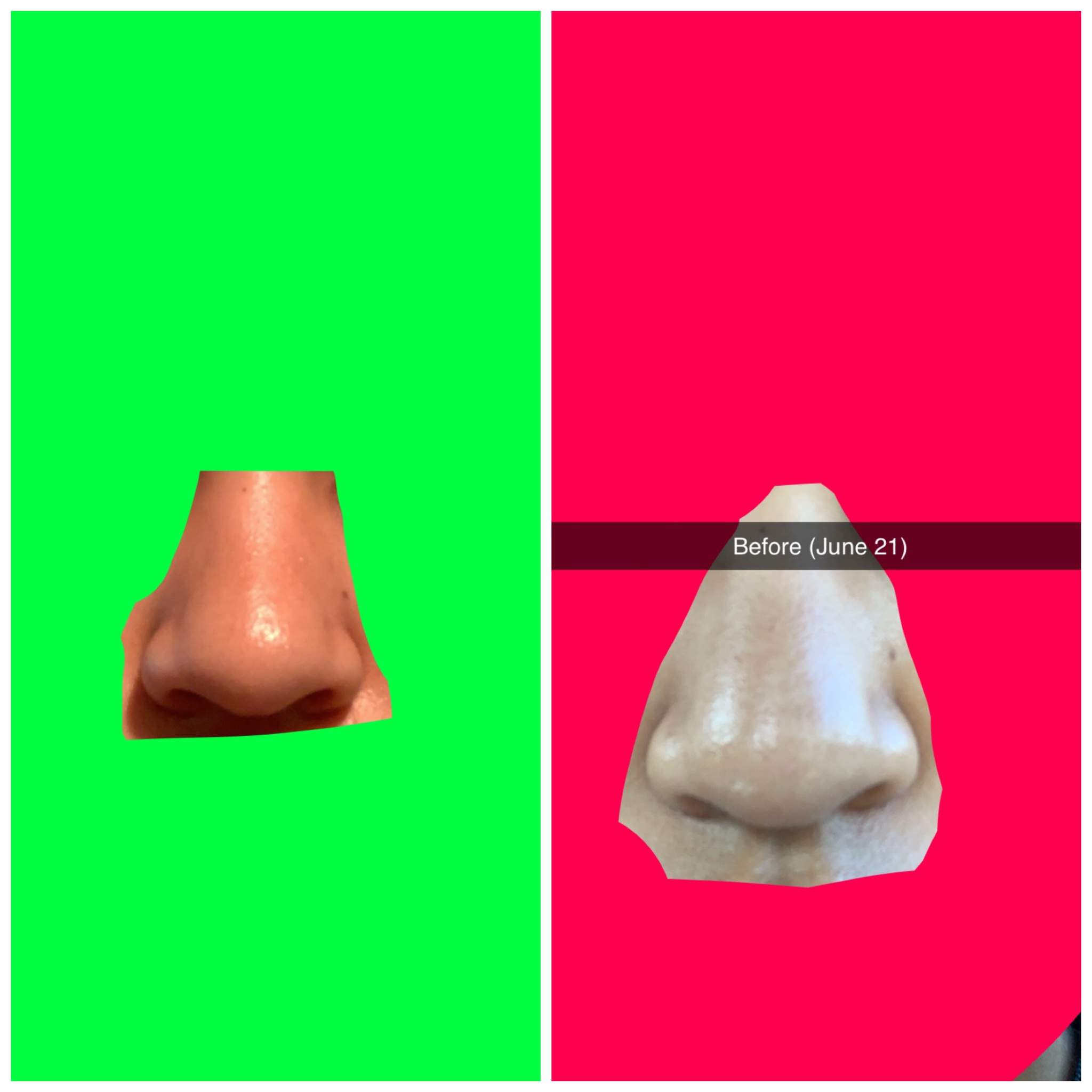 nose subliminal results