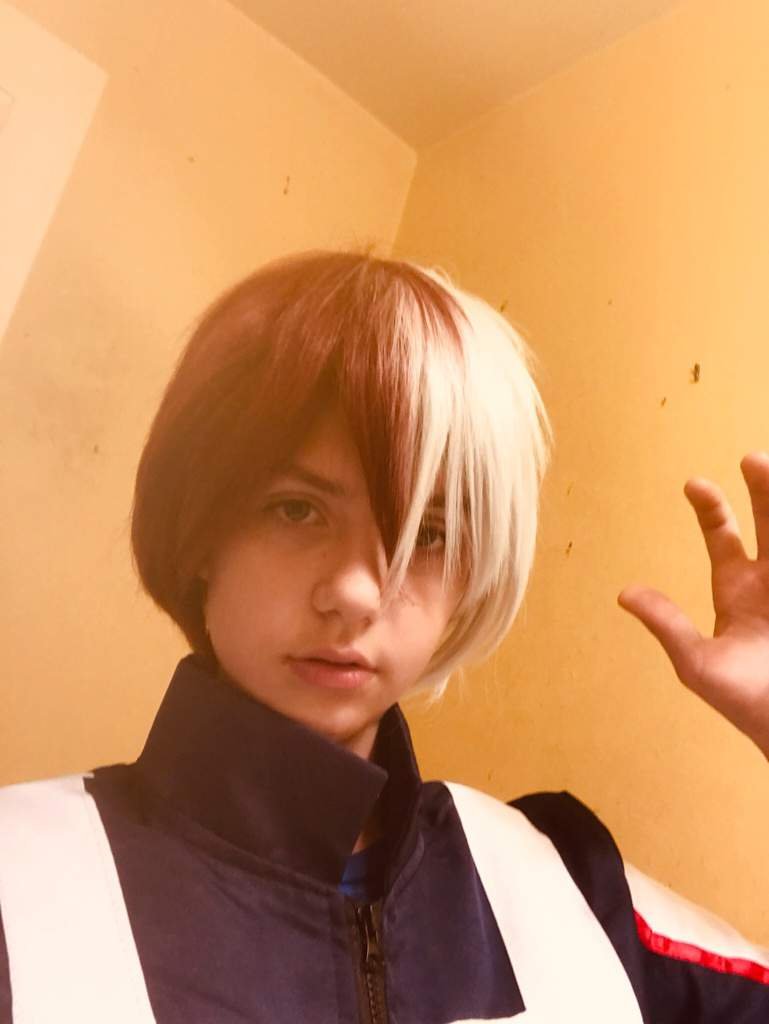 Todoroki with out the scar My Hero Academia Amino