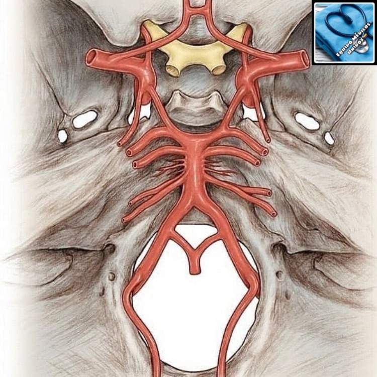 El Pol Gono De Willis Es El Rea De Uni N De Varias Arterias En La