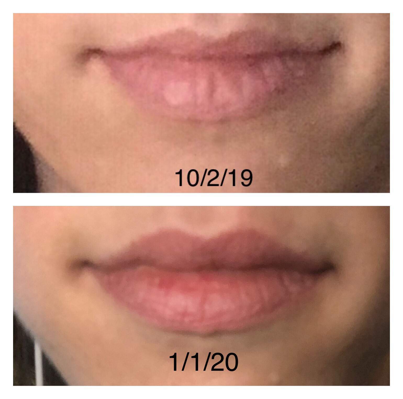 nose subliminal results amino
