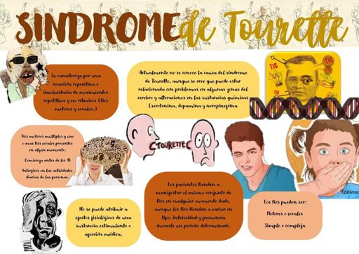 Cdp S Ndrome De Tourette Wiki Lgbt Espa Ol Amino