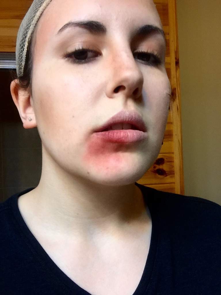 Makeup Bruises On Face - Mugeek Vidalondon