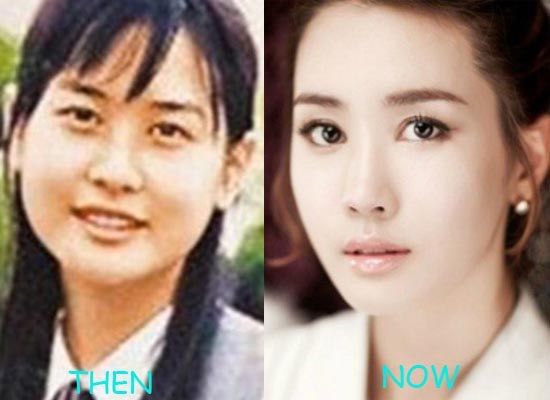 korean actors/actresses before and after plastic surgery | K-Drama Amino