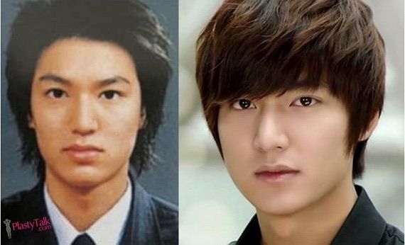 korean actors actresses before and after plastic surgery 