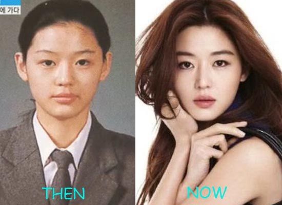 free korean actress plastic surgery