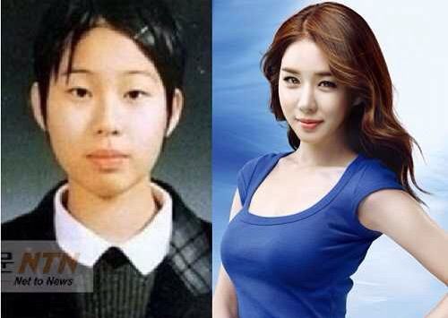 free korean actress plastic surgery