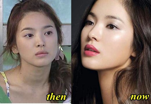 K-Drama Actresses Before And After | K-Drama Amino