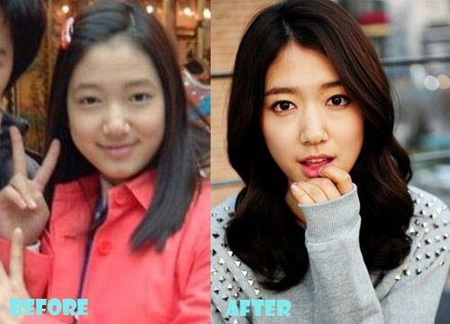 K-Drama Actresses Before And After | K-Drama Amino