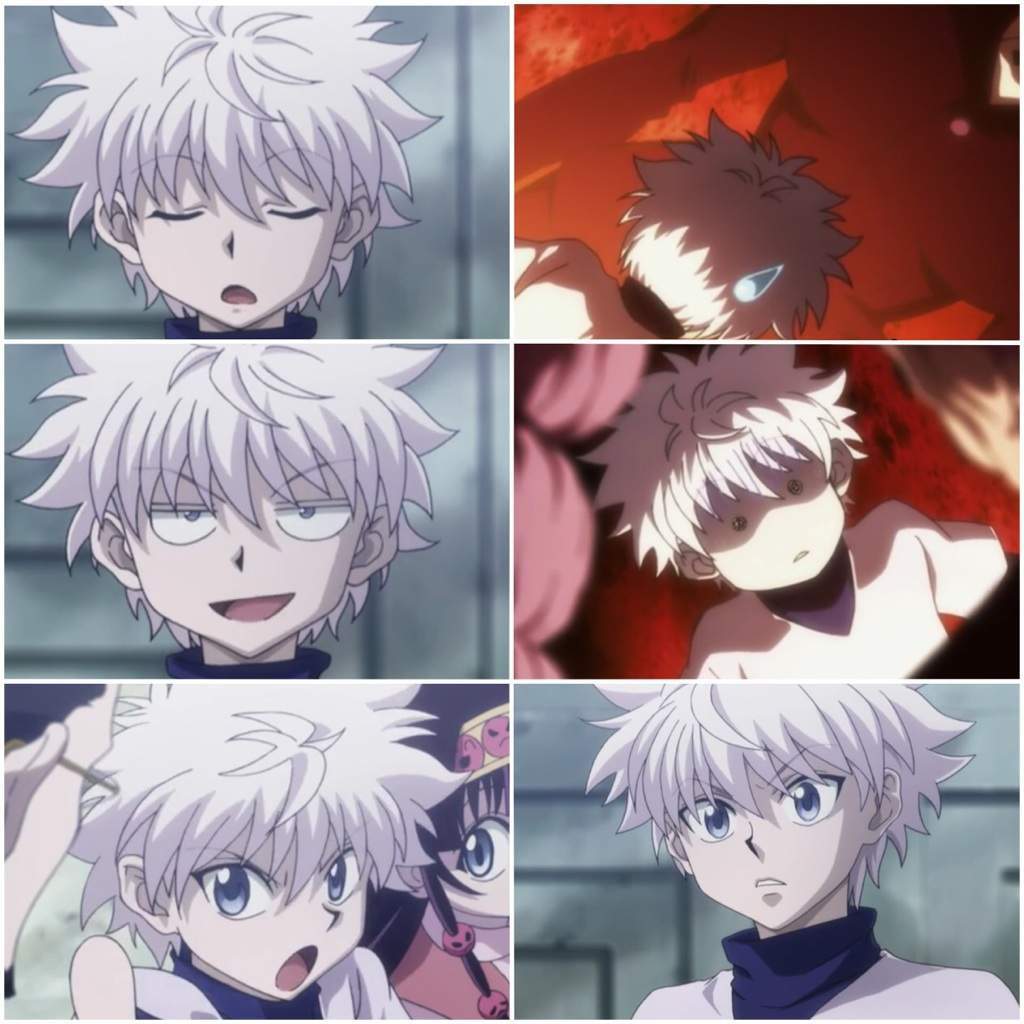 Killua References | Wiki | Anime Amino