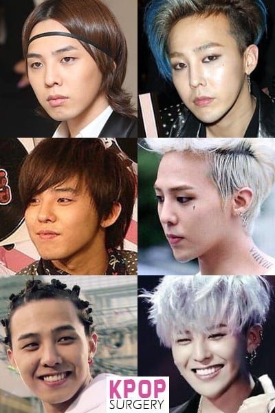 Kpop cirugias plasticas antes y despues de adelgazar