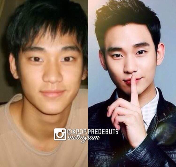 Korean celebrities before and now | K-Drama Amino