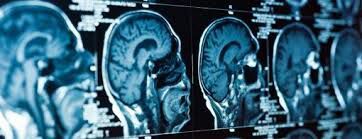 Neurology | Wiki | Science Amino