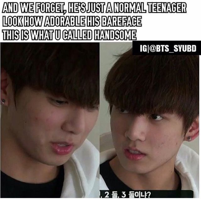 Jungkook Acne Bts Jungkook Then Vs Now Bts Korea Jiko - vrogue.co