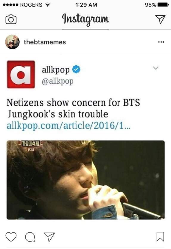 Jungkook Acne Bts Jungkook Then Vs Now Bts Korea Jiko - vrogue.co