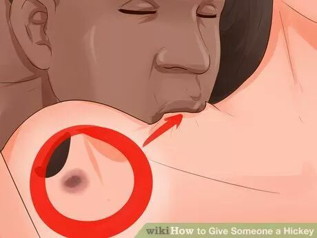 How to Give Someone a Hickey.