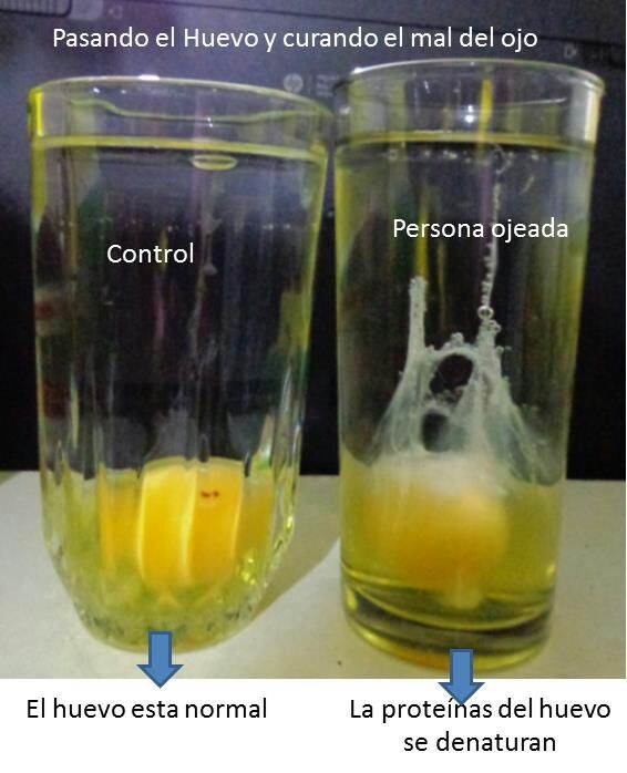 Lista 102+ Foto como saber leer el huevo después de una limpia Lleno