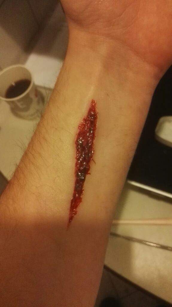 cut on arm