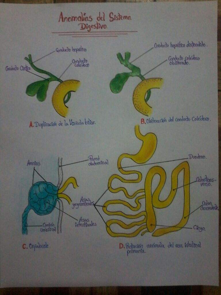 Dibujos Embriológicos de Anomalías📝 📝 | •Arte Amino• Amino