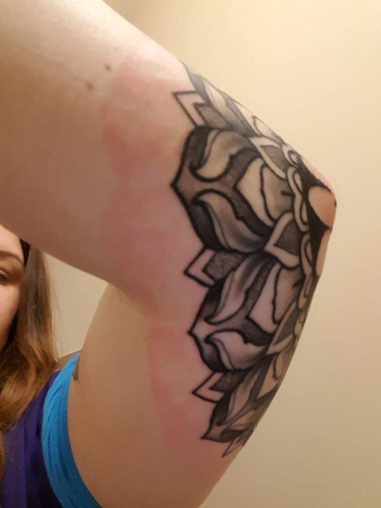 Reaction To Saniderm Tattoo Amino