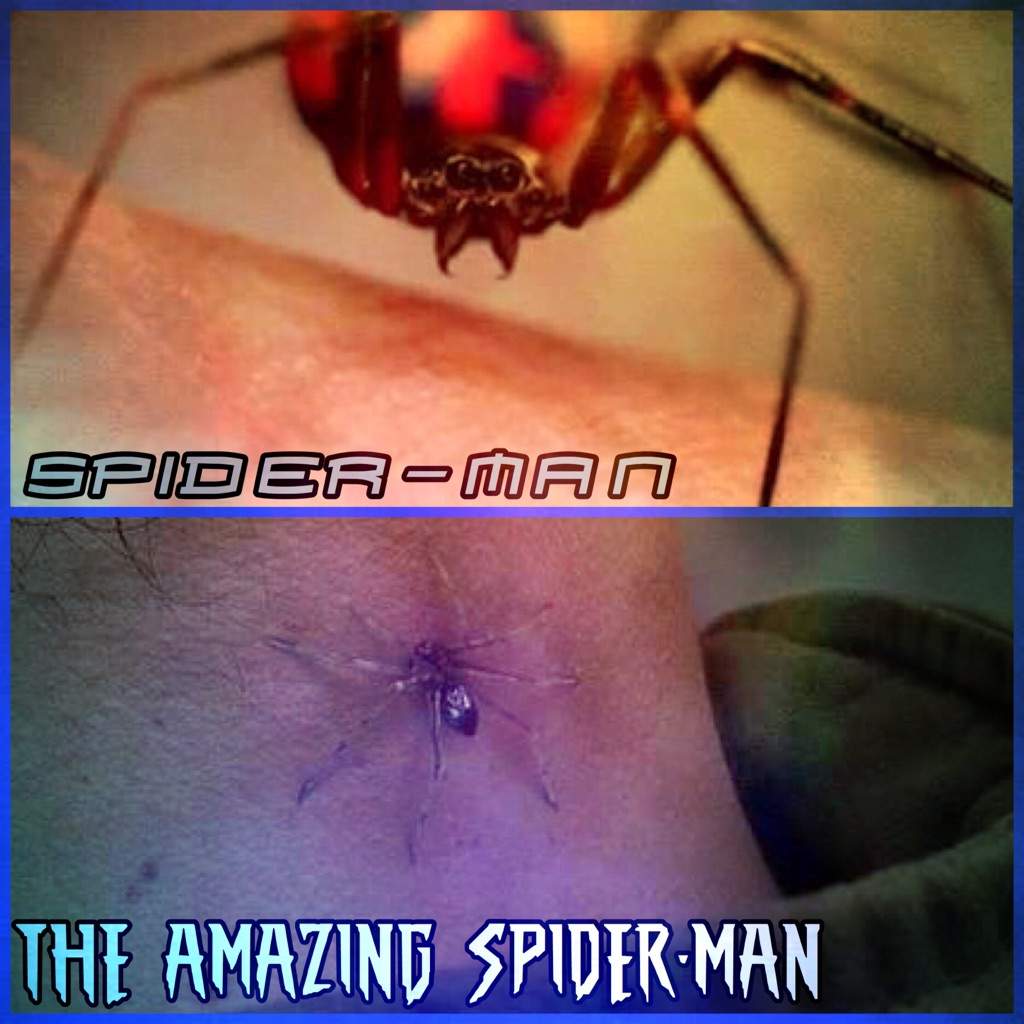 Araña Radioactiva (Spider-Man) | Wiki | •Cómics• Amino