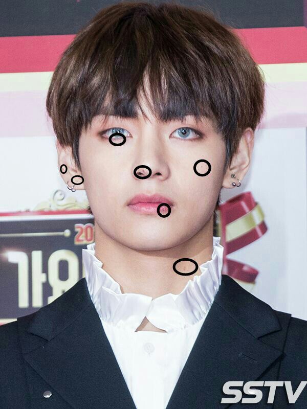 BTS Moles 101 ARMY's Amino