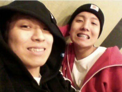 Hobi With Braces | J-Hope Amino