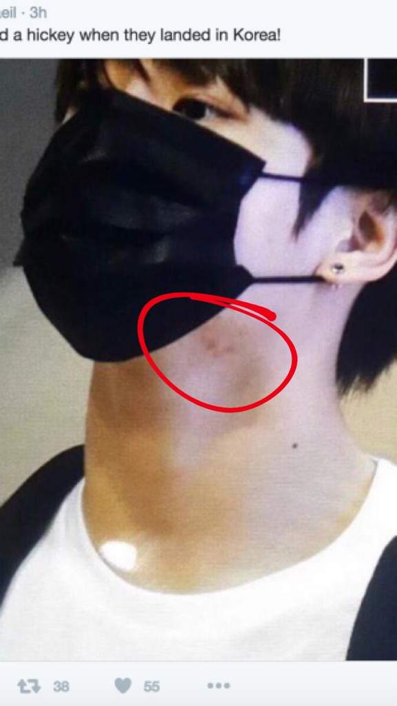 Jungkook And Tae Got Hickeys And Marks 👑kpop Addiction Community 👑 Amino