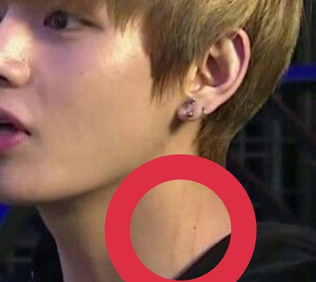 Jungkook & Tae got hickeys and marks? | ♥kpop Addiction♥♥BTS★EXO★GOT7♥