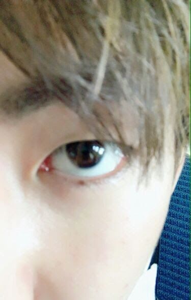 TAEHYUNG MOLE APPRECIATION | ARMY's Amino