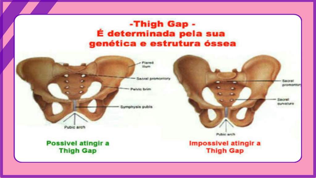 Thigh Gap Korean Style Br Amino