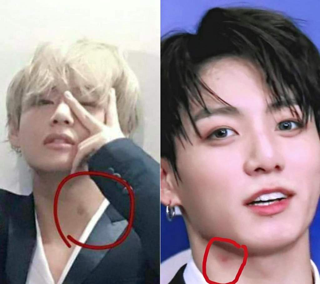 Times taekook were seen with hickeys👀💋 | V K O O K Amino