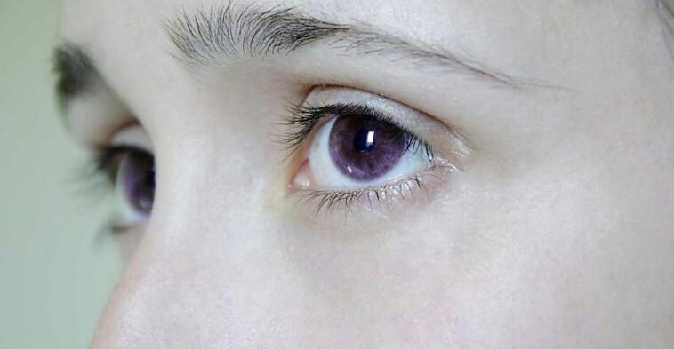 people with natural purple eyes