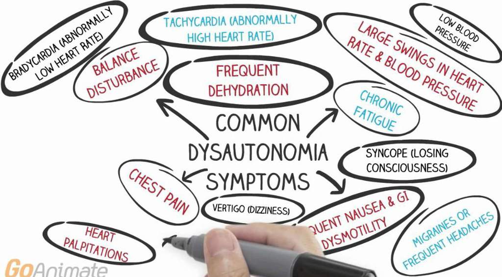 CARDIOVASCULAR AUTONOMIC DYSFUNCTION IN EDS Wiki EDS (Ehlers Danlos