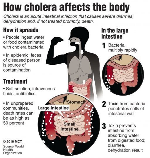 Cholera | Wiki | Infectious Diseases Amino