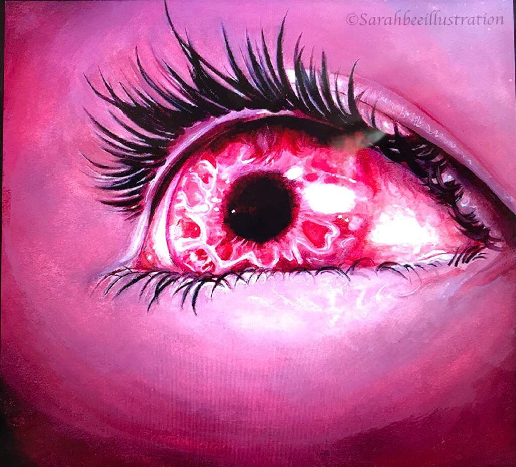 Pink Eye | Drawing Amino