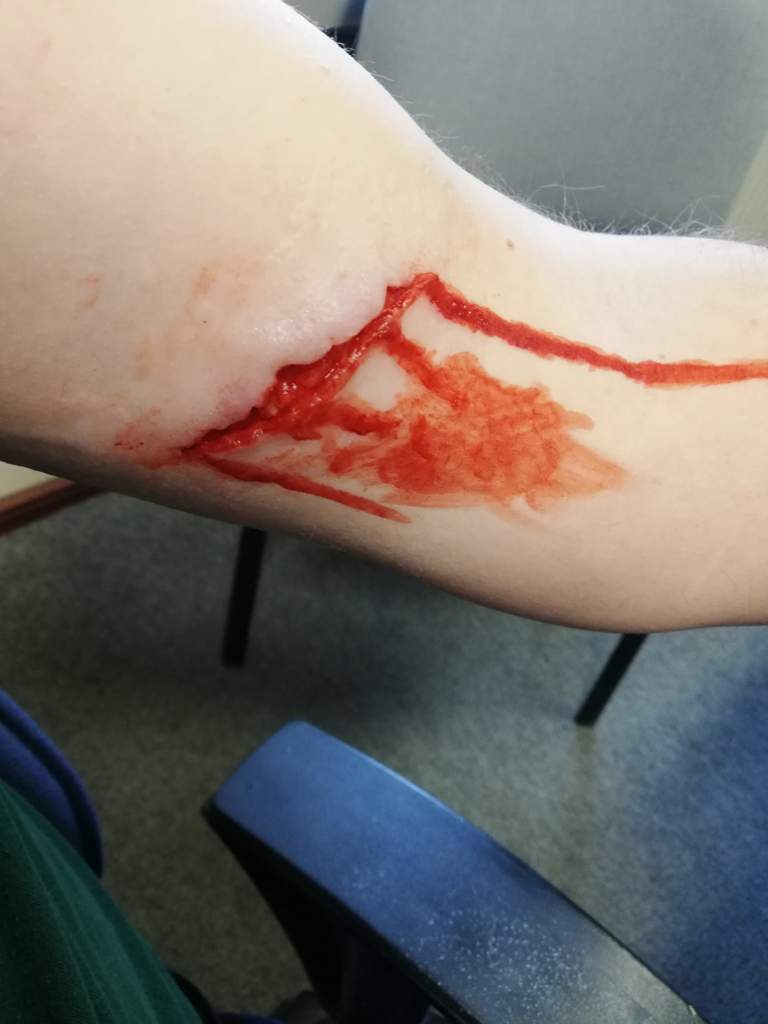 cut on arm