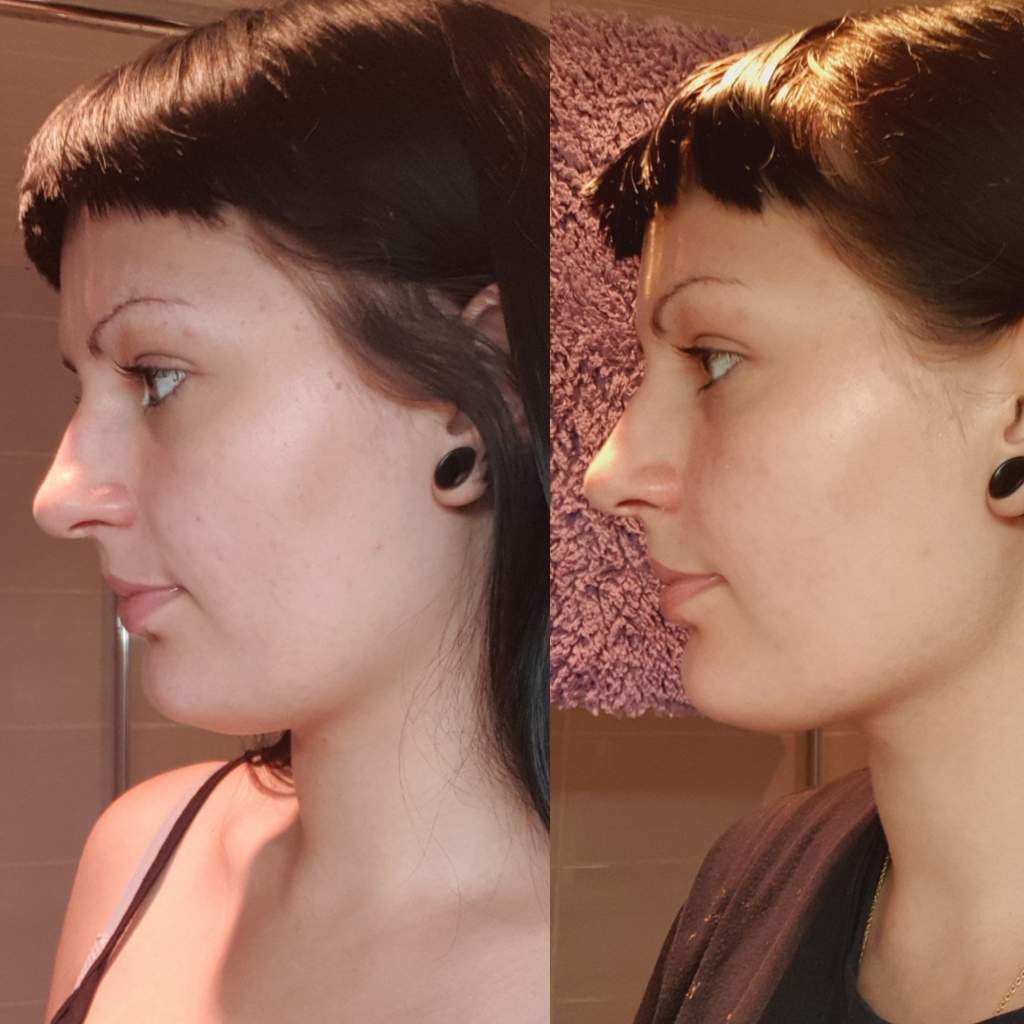 nose subliminal results nose subliminal results